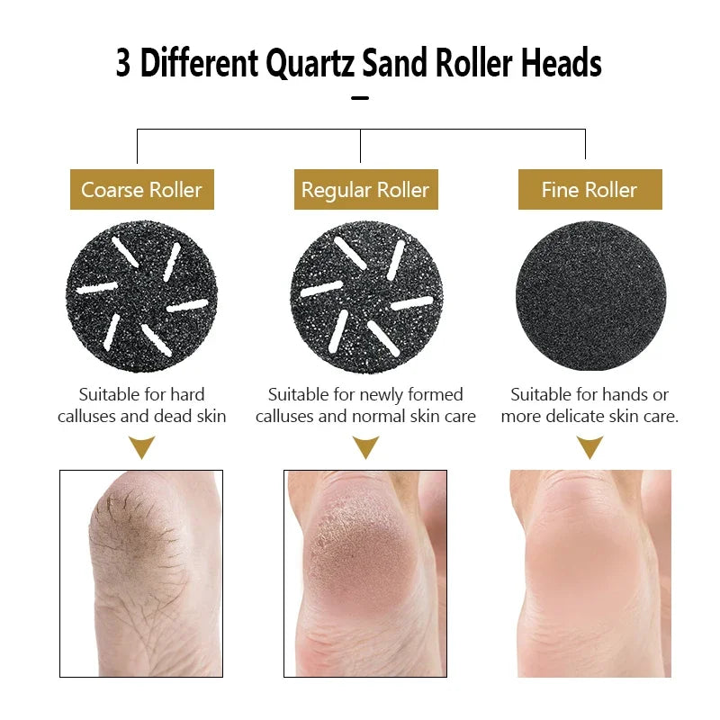 Electric Foot Callus Remover